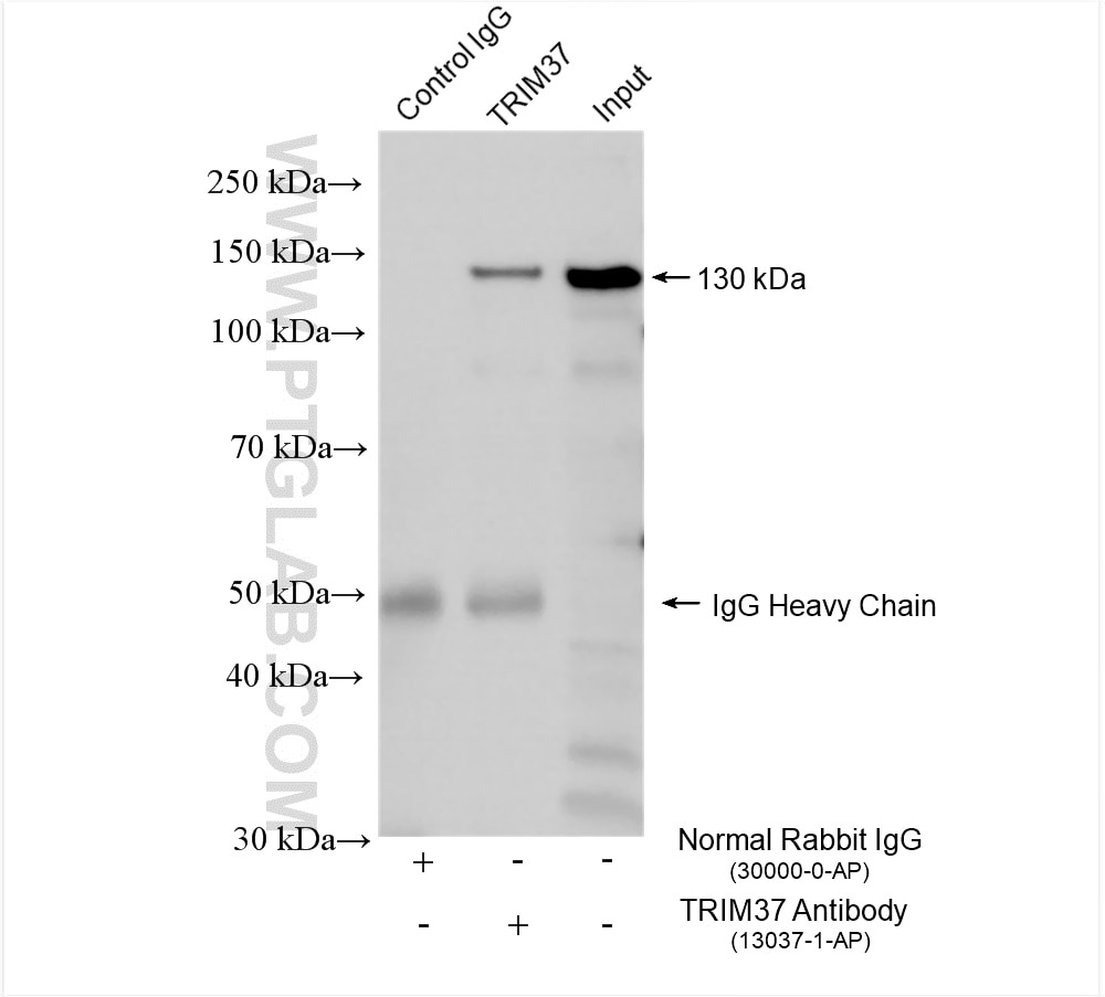 Immunoprecipitation (IP) experiment of mouse brain tissue using TRIM37 Polyclonal antibody (13037-1-AP)
