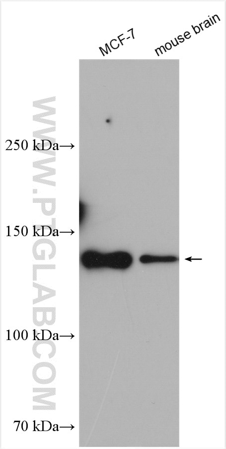 Western Blot (WB) analysis of various lysates using TRIM37 Polyclonal antibody (13037-1-AP)