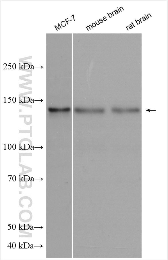 Western Blot (WB) analysis of various lysates using TRIM37 Polyclonal antibody (13037-1-AP)