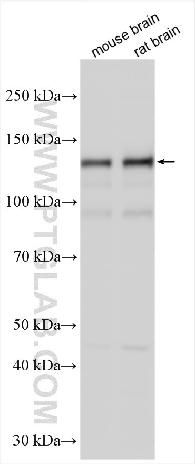 Western Blot (WB) analysis of various lysates using TRIM37 Polyclonal antibody (13037-1-AP)