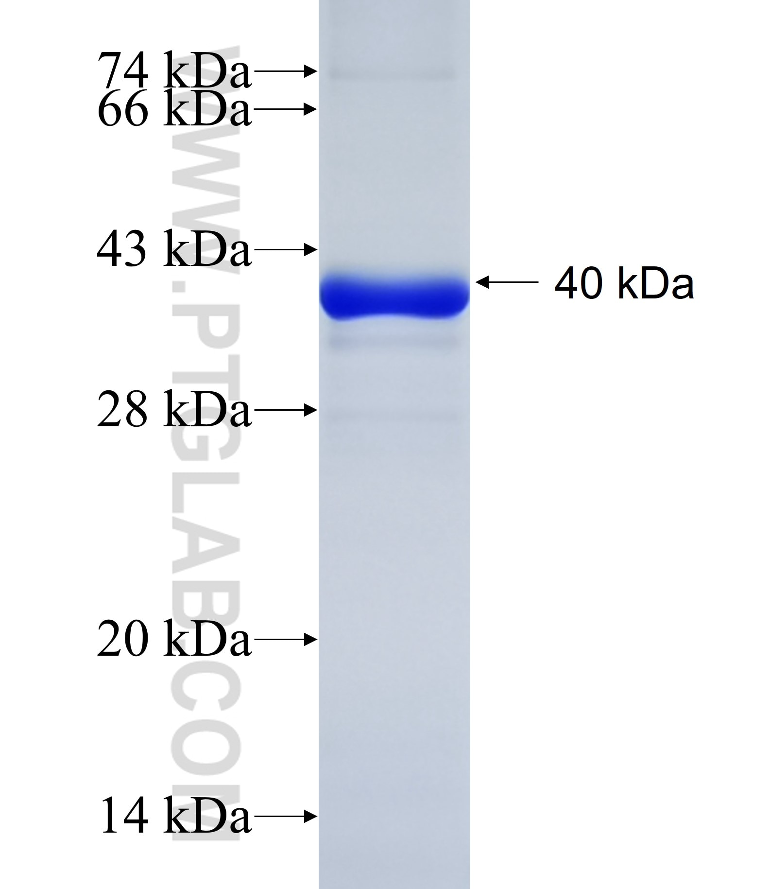 TRIM37 fusion protein Ag34699 SDS-PAGE TRIM37 fusion protein Ag34699 SDS-PAGE
