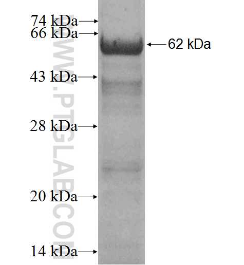TRIM37 fusion protein Ag3690 SDS-PAGE