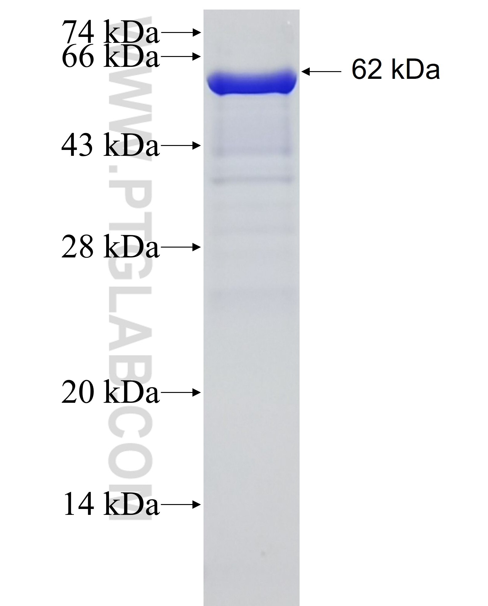 TRIM37 fusion protein Ag3690 SDS-PAGE