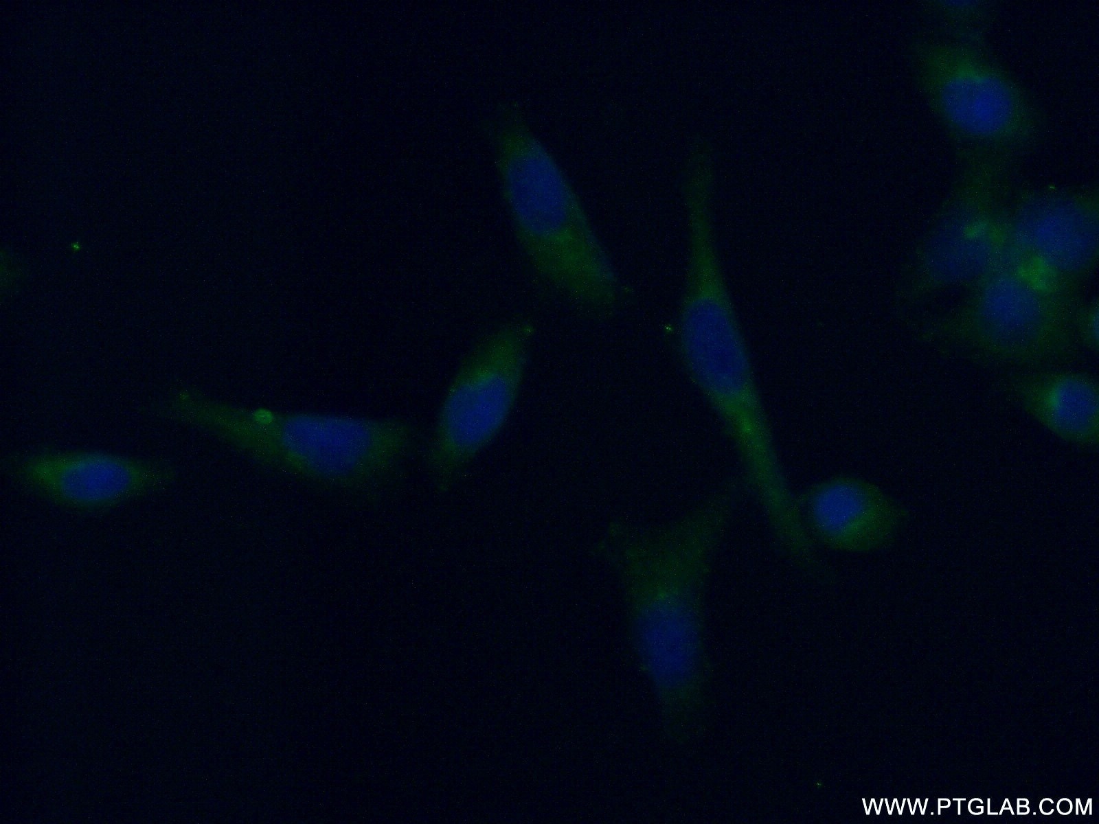 Immunofluorescence (IF) / fluorescent staining of L02 cells using TRIM38 Polyclonal antibody (13405-1-AP)