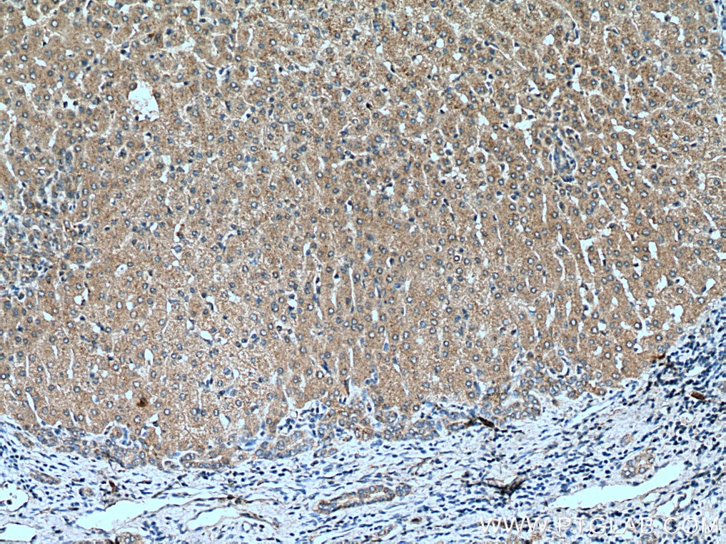 Immunohistochemistry (IHC) staining of human liver tissue using TRIM38 Polyclonal antibody (13405-1-AP)