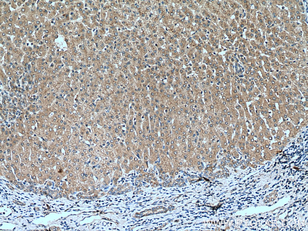 Immunohistochemistry (IHC) staining of human liver tissue using TRIM38 Polyclonal antibody (13405-1-AP)