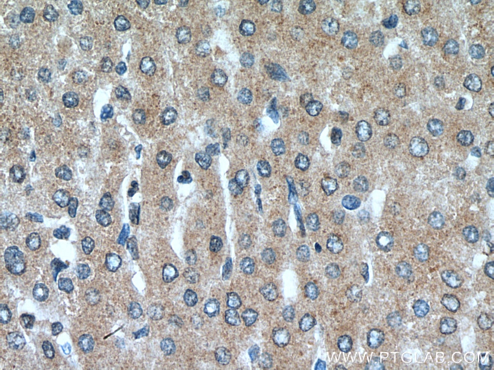 Immunohistochemistry (IHC) staining of human liver tissue using TRIM38 Polyclonal antibody (13405-1-AP)