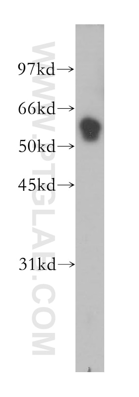 Western Blot (WB) analysis of human liver tissue using TRIM38 Polyclonal antibody (13405-1-AP)