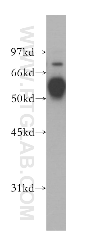 Western Blot (WB) analysis of HEK-293 cells using TRIM38 Polyclonal antibody (13405-1-AP)