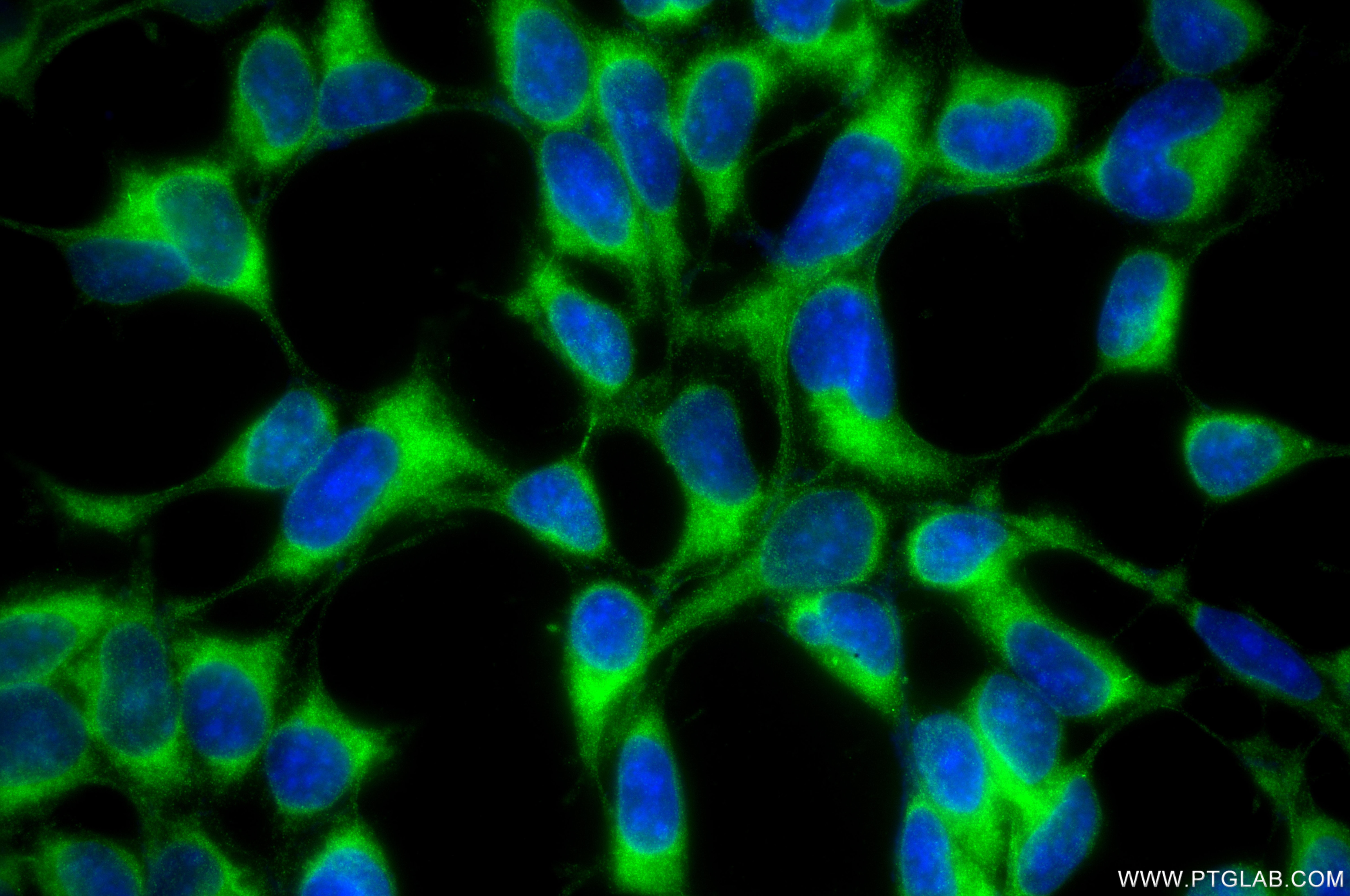 Immunofluorescent analysis of (-20°C Methanol) fixed HEK-293 cells using TRIM38 antibody (87196-1-RR, Clone: 252271E8 ) at dilution of 1:400 and CoraLite®488-Conjugated Goat Anti-Rabbit IgG(H+L) (SA00013-2). Immunofluorescence (IF) / fluorescent staining of HEK-293 cells using TRIM38 Recombinant monoclonal antibody (87196-1-RR)