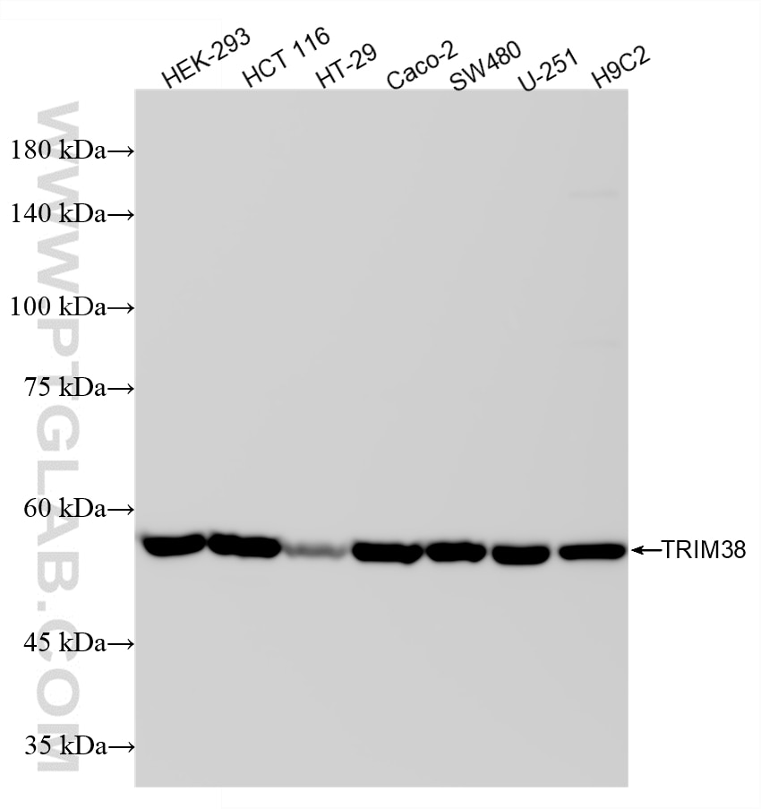 Various lysates were subjected to SDS PAGE followed by western blot with 87196-1-RR (TRIM38 antibody) at dilution of 1:10000 incubated at room temperature for 1.5 hours. Western Blot (WB) analysis of various lysates using TRIM38 Recombinant monoclonal antibody (87196-1-RR)