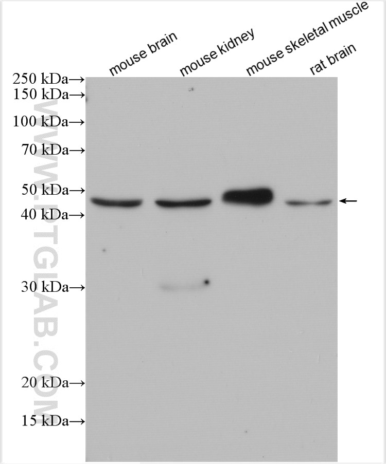 Western Blot (WB) analysis of various lysates using TRIM39 Polyclonal antibody (12757-1-AP)