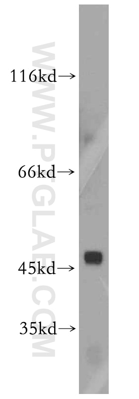 Western Blot (WB) analysis of mouse skeletal muscle tissue using TRIM39 Polyclonal antibody (12757-1-AP)