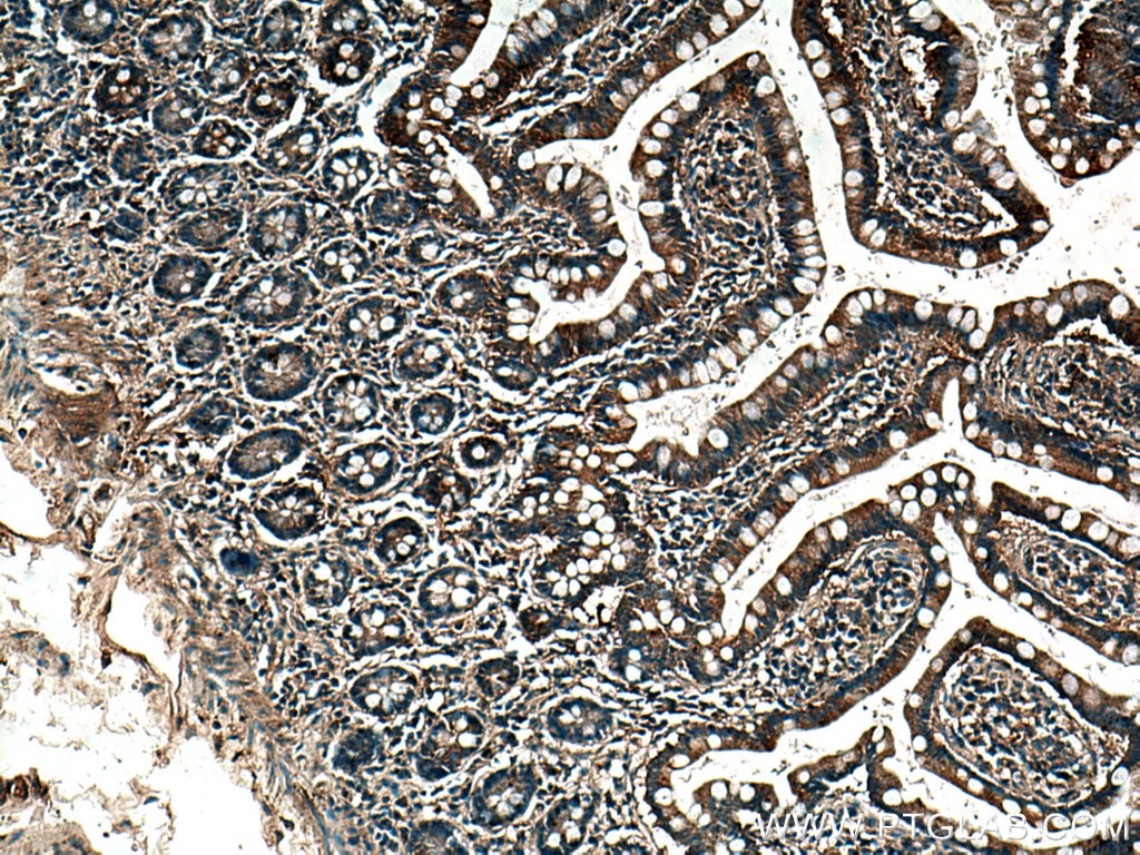 Immunohistochemistry (IHC) staining of human small intestine tissue using TRIM40 Monoclonal antibody (67073-1-Ig)