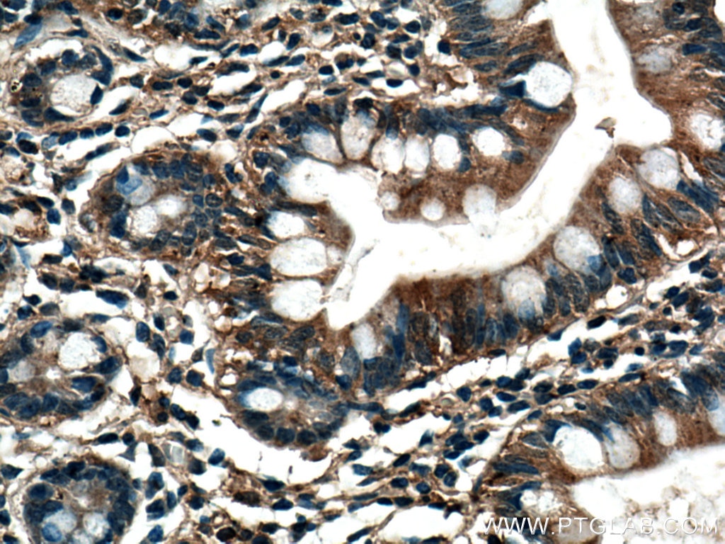 Immunohistochemistry (IHC) staining of human small intestine tissue using TRIM40 Monoclonal antibody (67073-1-Ig)