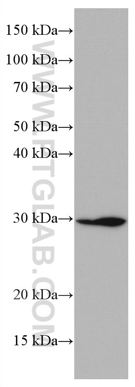 WB analysis of pig small intestine using 67073-1-Ig