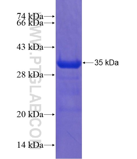TRIM40 fusion protein Ag21660 SDS-PAGE