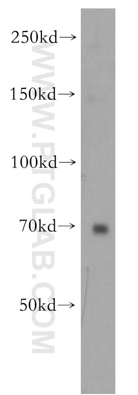 Western Blot (WB) analysis of human placenta tissue using TRIM41 Polyclonal antibody (18468-1-AP)