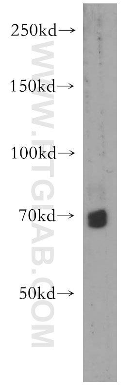 Western Blot (WB) analysis of mouse liver tissue using TRIM41 Polyclonal antibody (18468-1-AP)