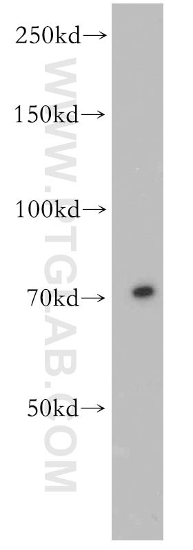 Western Blot (WB) analysis of BxPC-3 cells using TRIM41 Polyclonal antibody (18468-1-AP)