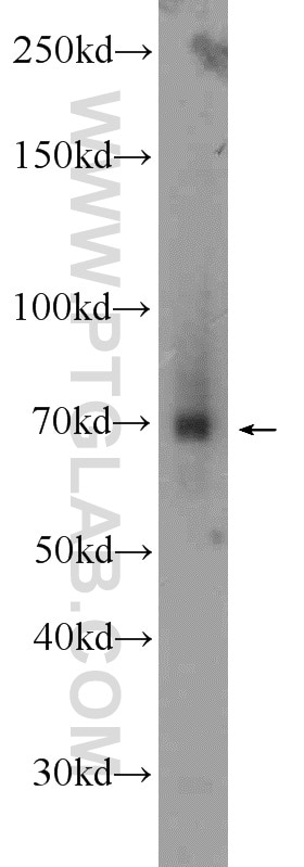 Western Blot (WB) analysis of human placenta tissue using TRIM41 Polyclonal antibody (18468-1-AP)