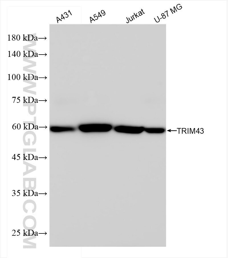 Western Blot (WB) analysis of various lysates using TRIM43 Recombinant antibody (84354-1-RR)