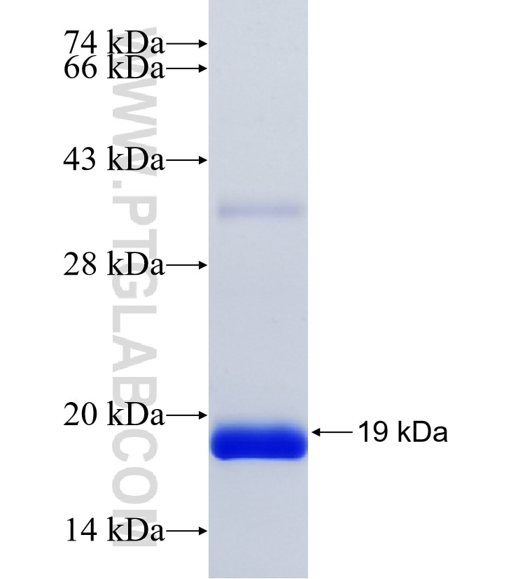 TRIM43 fusion protein Ag34920 SDS-PAGE