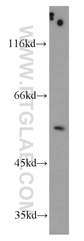 Western Blot (WB) analysis of mouse testis tissue using TRIM44 Polyclonal antibody (11511-1-AP)