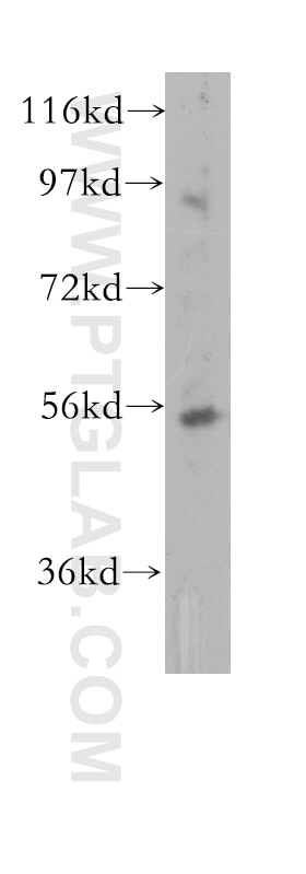 Western Blot (WB) analysis of human liver tissue using TRIM44 Polyclonal antibody (11511-1-AP)