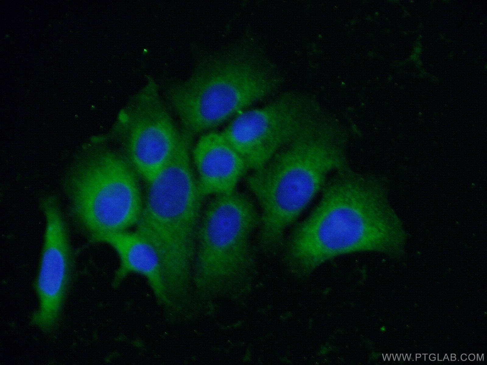 Immunofluorescence (IF) / fluorescent staining of MCF-7 cells using TRIM44 Monoclonal antibody (66249-1-Ig)