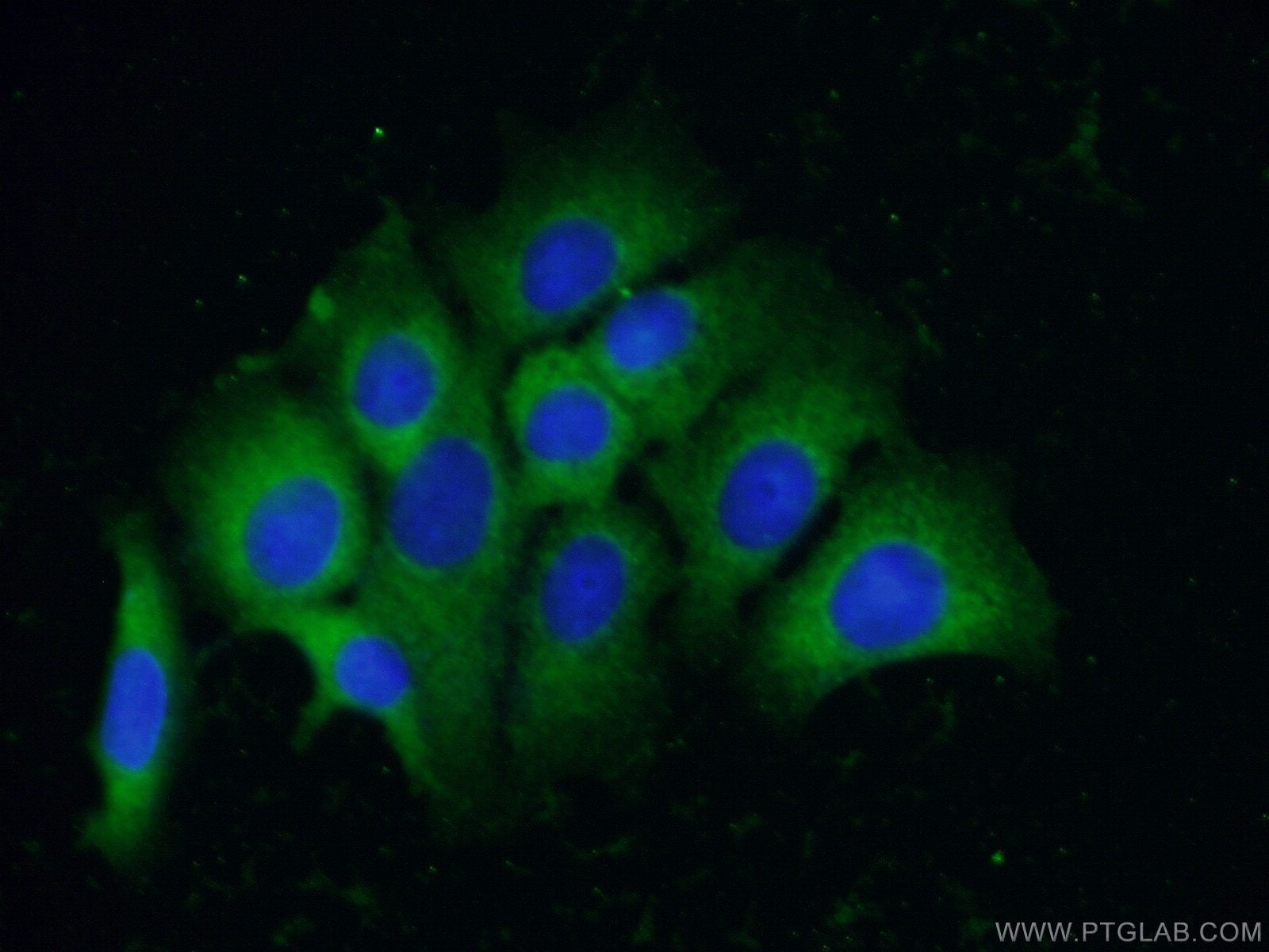 IF Staining of MCF-7 using 66249-1-Ig