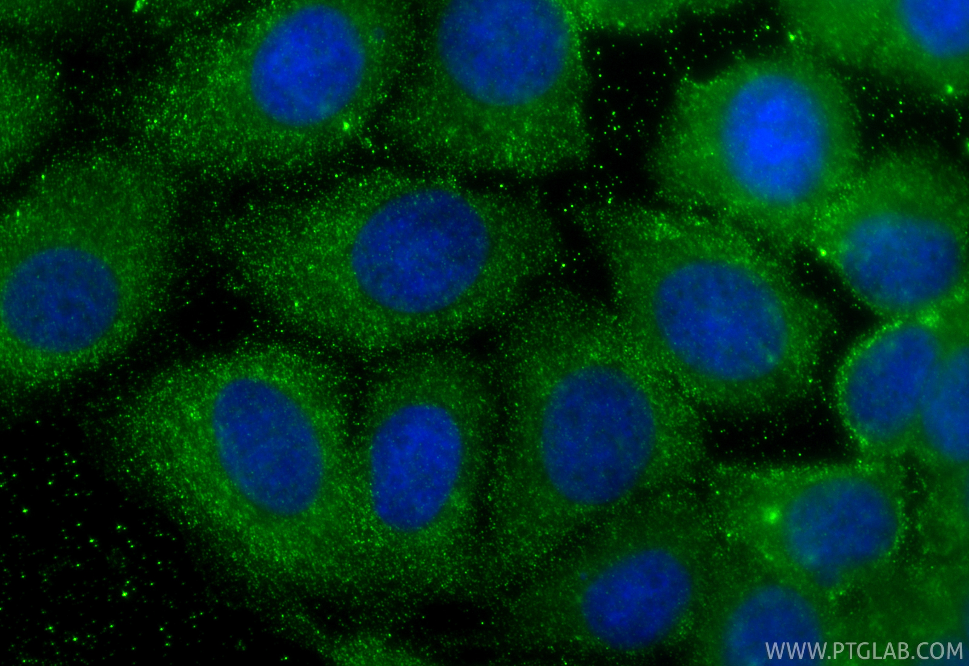 Immunofluorescent analysis of (-20°C Methanol) fixed MCF-7 cells using TRIM44 antibody (66249-1-Ig, Clone: 1B12H12 ) at dilution of 1:400 and CoraLite®488-Conjugated Goat Anti-Mouse IgG(H+L) (SA00013-1). Immunofluorescence (IF) / fluorescent staining of MCF-7 cells using TRIM44 Monoclonal antibody (66249-1-Ig)