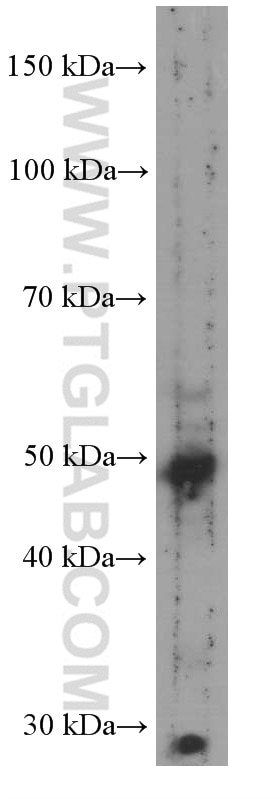 Western Blot (WB) analysis of human testis tissue using TRIM44 Monoclonal antibody (66249-1-Ig)