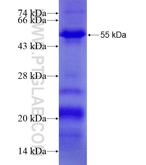 TRIM44 fusion protein Ag18771 SDS-PAGE