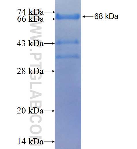 TRIM44 fusion protein Ag2070 SDS-PAGE