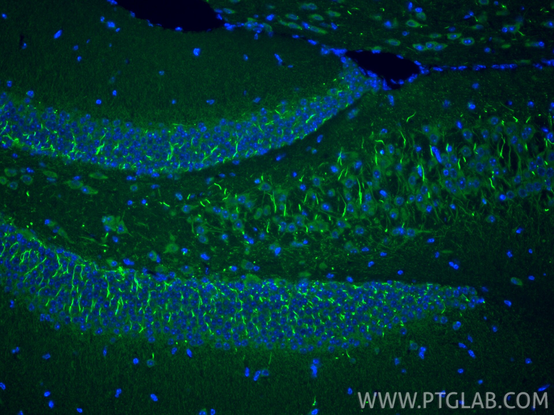Immunofluorescence (IF) / fluorescent staining of mouse brain tissue using TRIM46 Polyclonal antibody (21026-1-AP)