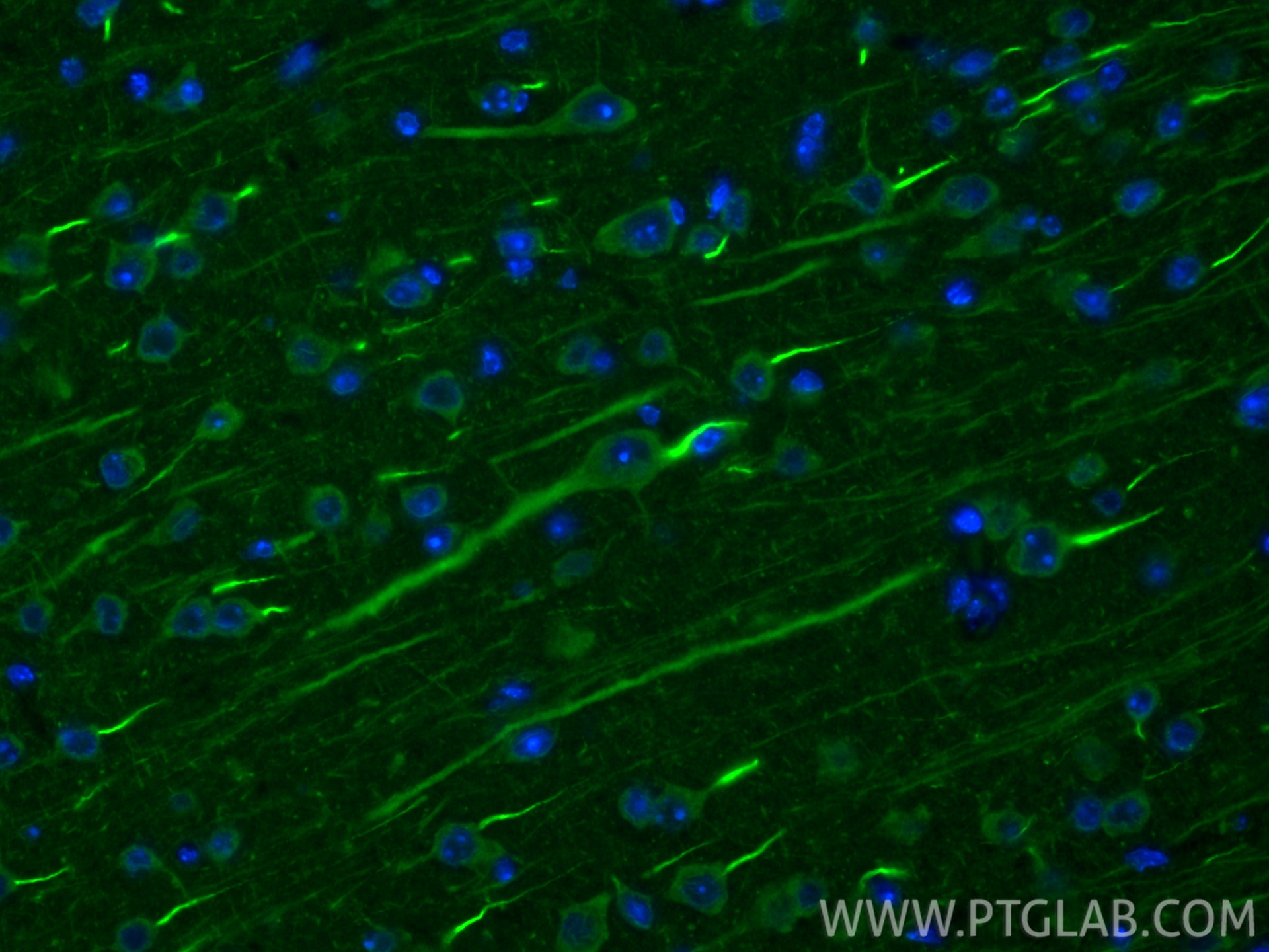 Immunofluorescence (IF) / fluorescent staining of mouse brain tissue using TRIM46 Polyclonal antibody (21026-1-AP)