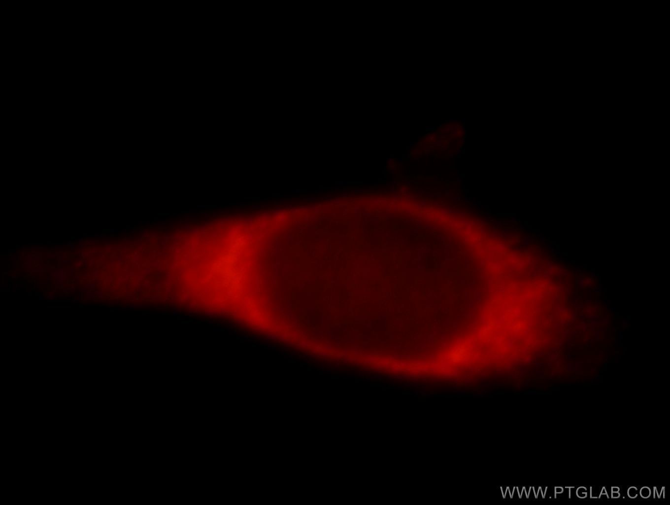 Immunofluorescence (IF) / fluorescent staining of HeLa cells using TRIM46 Polyclonal antibody (21026-1-AP)