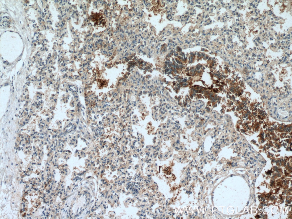 Immunohistochemistry (IHC) staining of human lung tissue using TRIM46 Polyclonal antibody (21026-1-AP)