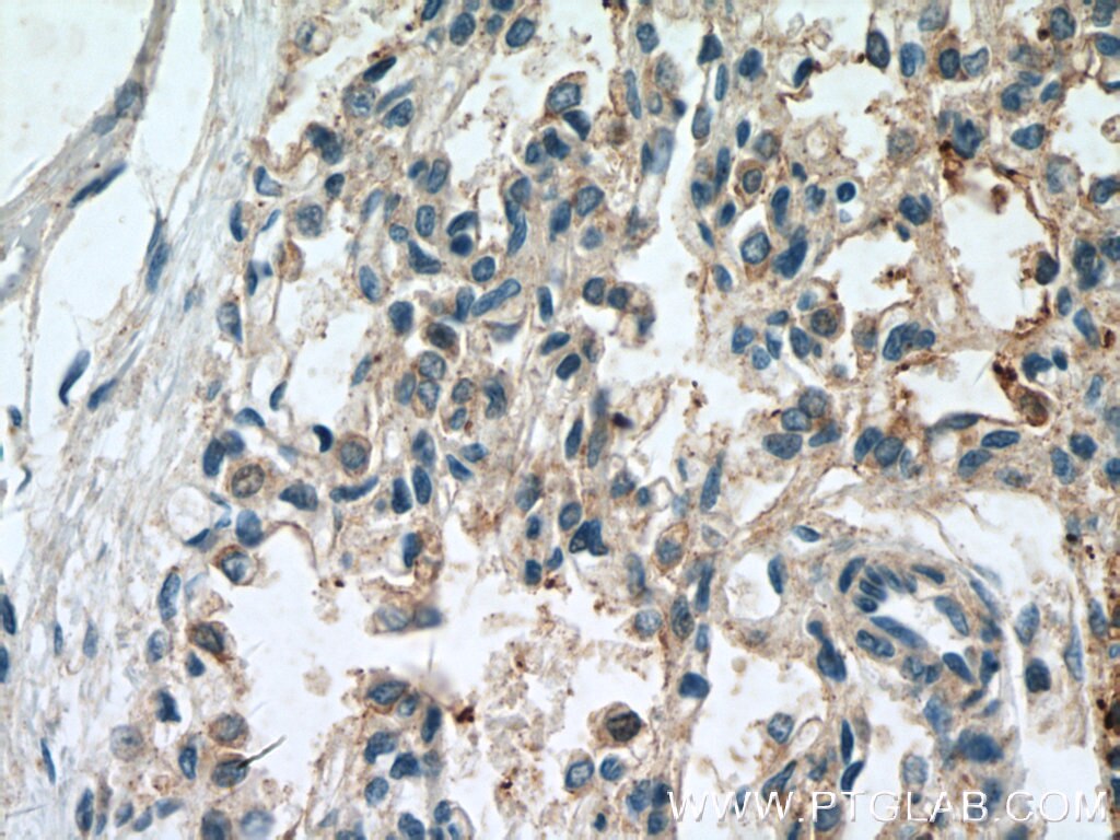 Immunohistochemistry (IHC) staining of human lung tissue using TRIM46 Polyclonal antibody (21026-1-AP)