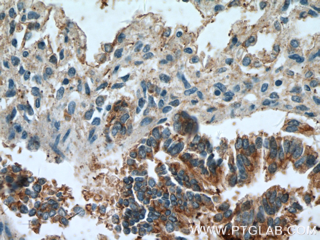 Immunohistochemistry (IHC) staining of human lung tissue using TRIM46 Polyclonal antibody (21026-1-AP)