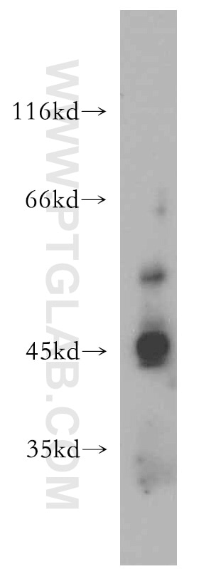 Western Blot (WB) analysis of HeLa cells using TRIM46 Polyclonal antibody (21026-1-AP)