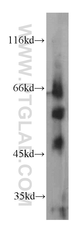 Western Blot (WB) analysis of mouse lung tissue using TRIM46 Polyclonal antibody (21026-1-AP)