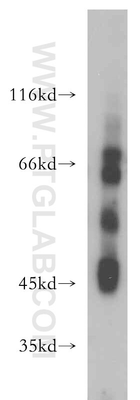 Western Blot (WB) analysis of mouse testis tissue using TRIM46 Polyclonal antibody (21026-1-AP)