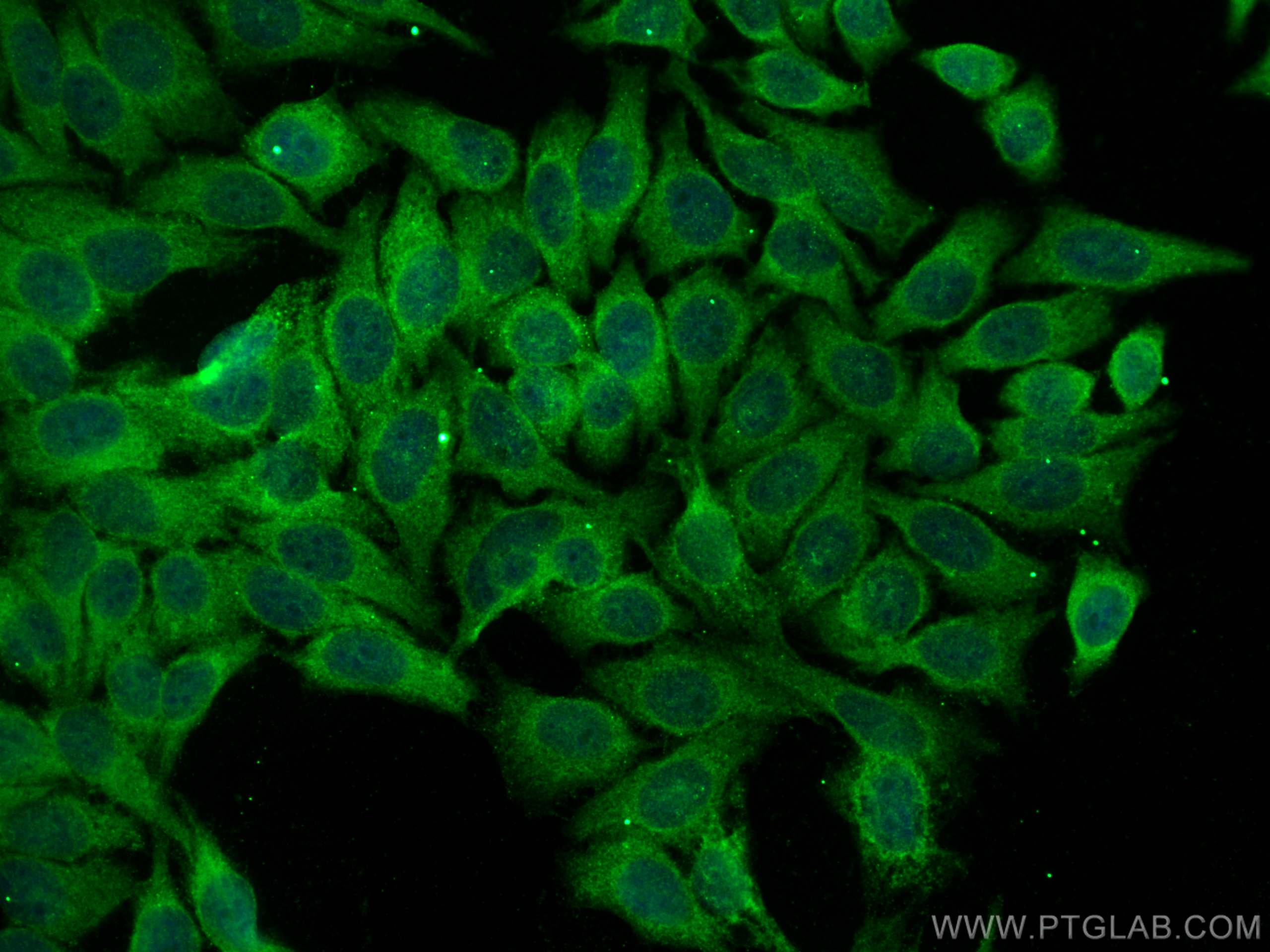 Immunofluorescence (IF) / fluorescent staining of HepG2 cells using TRIM46 Polyclonal antibody (30298-1-AP)