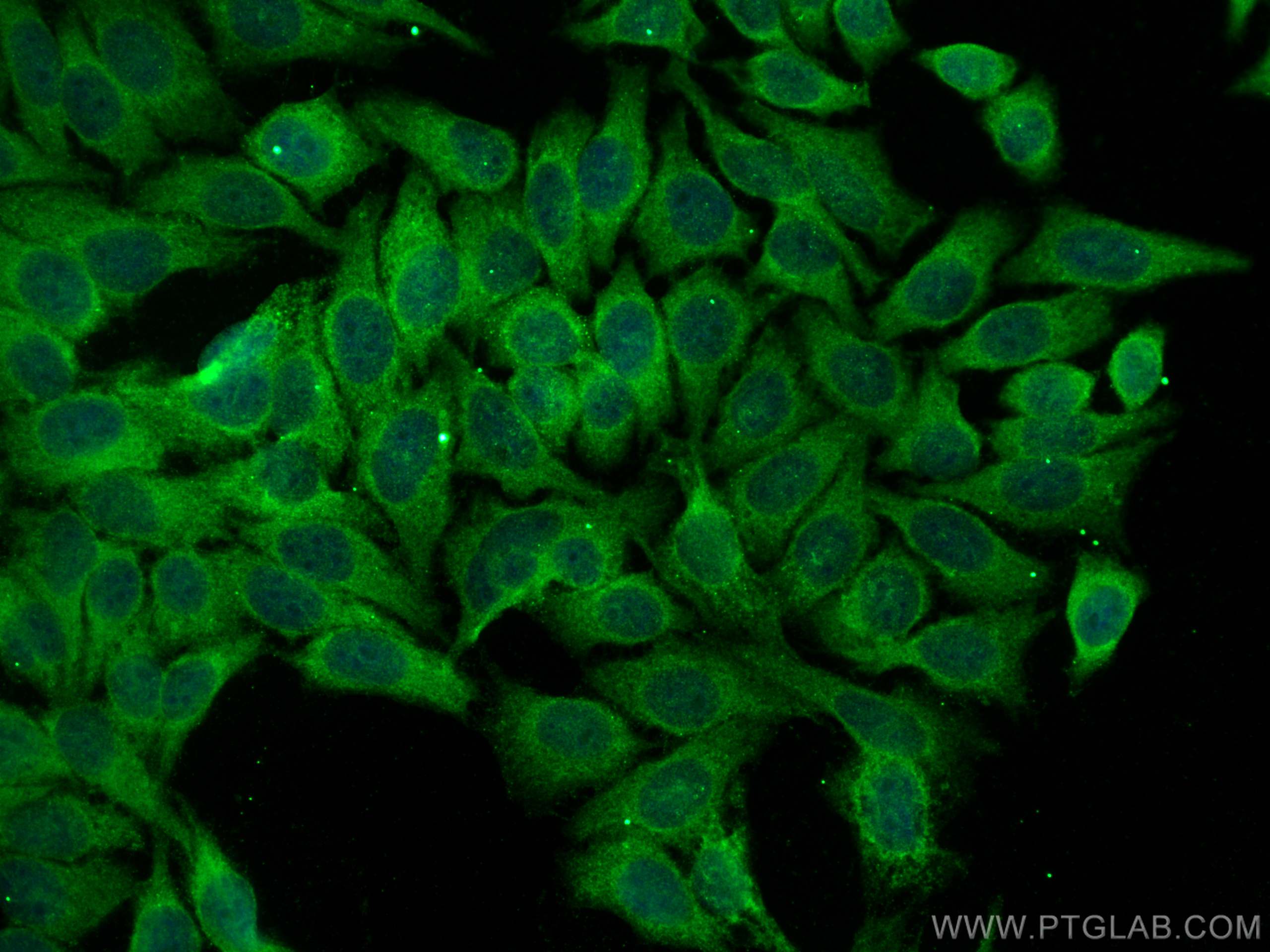 IF Staining of HepG2 using 30298-1-AP