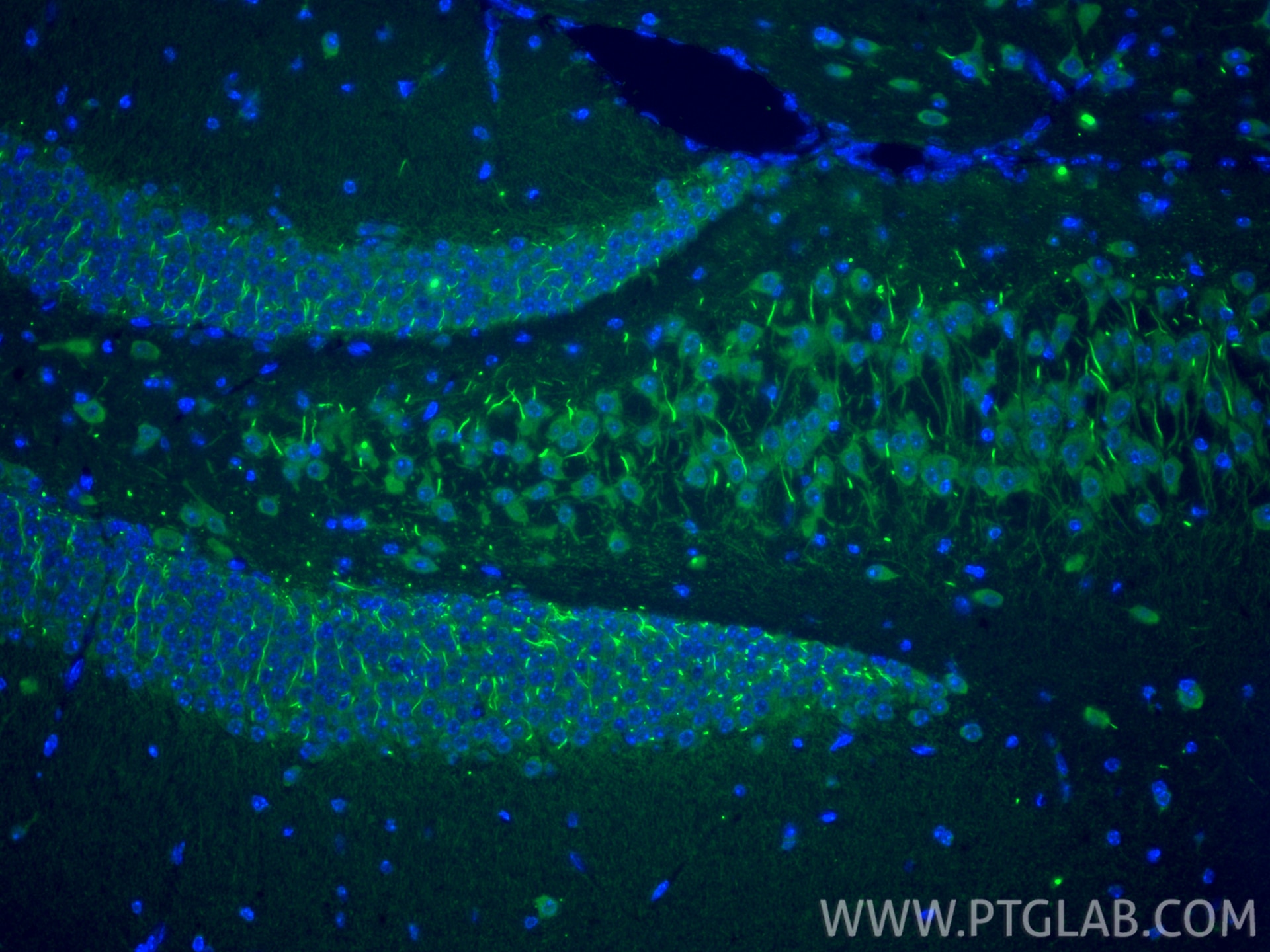Immunofluorescence (IF) / fluorescent staining of mouse brain tissue using TRIM46 Polyclonal antibody (30298-1-AP)