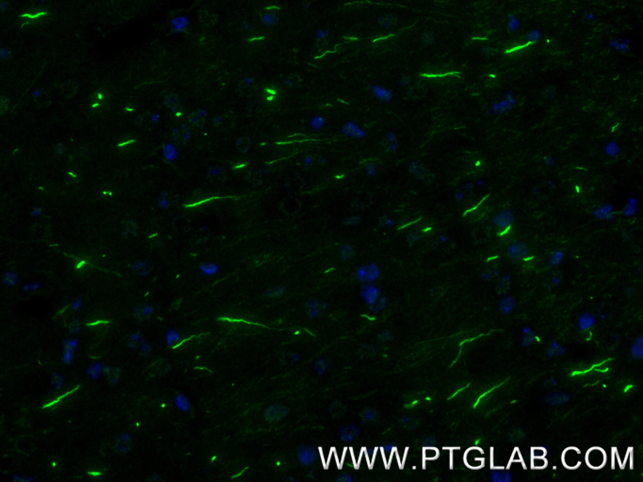 Immunofluorescence (IF) / fluorescent staining of mouse brain tissue using TRIM46 Recombinant antibody (83614-2-RR)
