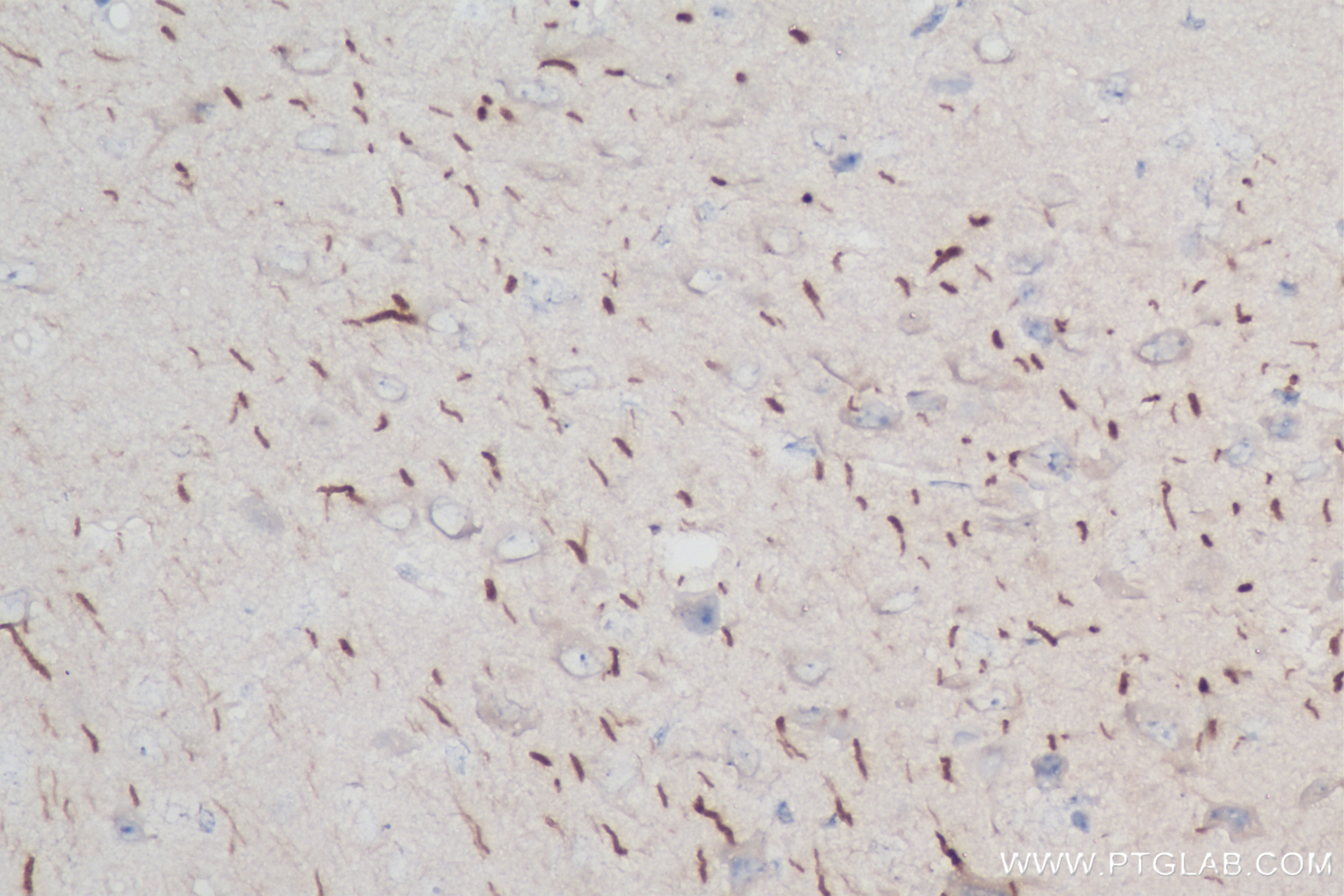 Immunohistochemistry (IHC) staining of mouse brain tissue using TRIM46 Recombinant antibody (83614-2-RR)