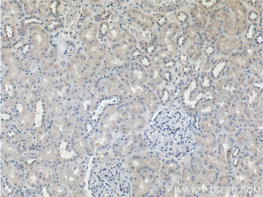 Immunohistochemistry (IHC) staining of human kidney tissue using TRIM47 Polyclonal antibody (26885-1-AP)